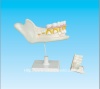 children half lower jaw model