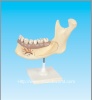 Half lower jaw model