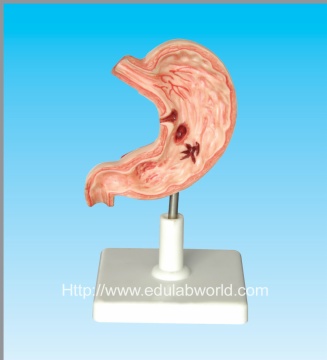 Human stomach model
