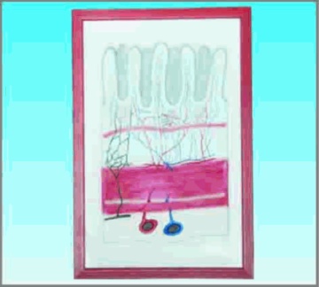 Enlarged alimentary canel